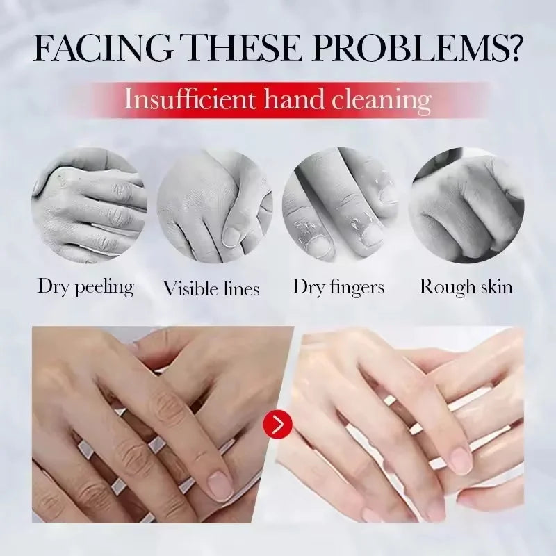 Fast Brighten Dark Knuckles Cream Whiting Hand Cream Lighten Melanin Stains Corrector Hand Anti Crack Soften Moisturize Product