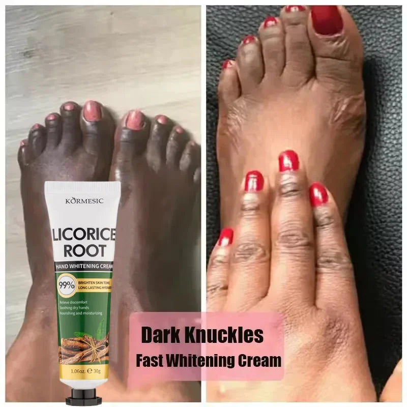 Fast Brighten Dark Knuckles Cream Whiting Hand Cream Lighten Melanin Stains Corrector Hand Anti Crack Soften Moisturize Product