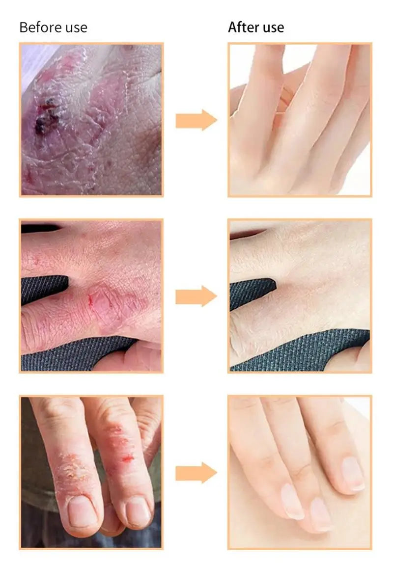 Fast Brighten Dark Knuckles Cream Whiting Hand Cream Lighten Melanin Stains Corrector Hand Anti Crack Soften Moisturize Product
