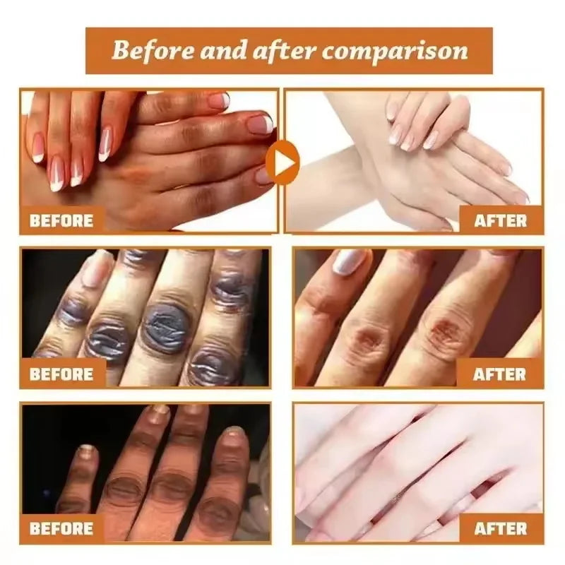 Fast Brighten Dark Knuckles Cream Whiting Hand Cream Lighten Melanin Stains Corrector Hand Anti Crack Soften Moisturize Product