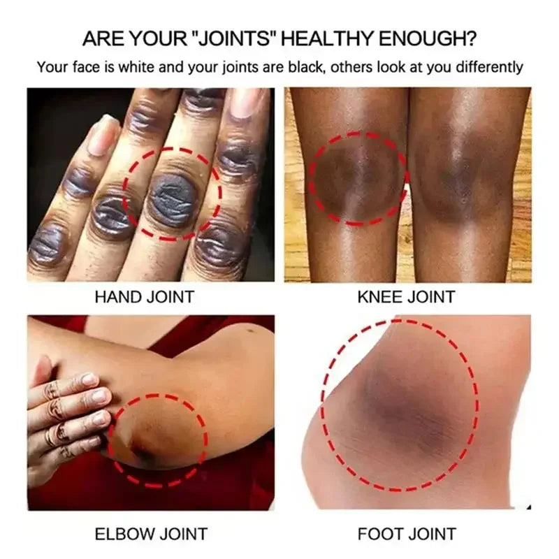 Fast Brighten Dark Knuckles Cream Whiting Hand Cream Lighten Melanin Stains Corrector Hand Anti Crack Soften Moisturize Product