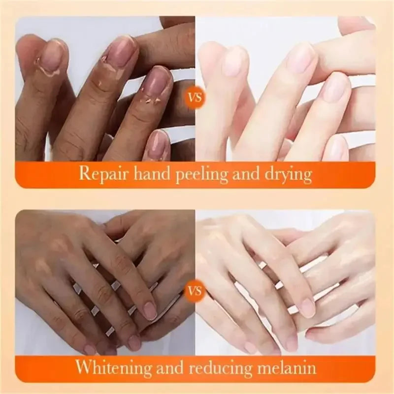 Fast Brighten Dark Knuckles Cream Whiting Hand Cream Lighten Melanin Stains Corrector Hand Anti Crack Soften Moisturize Product